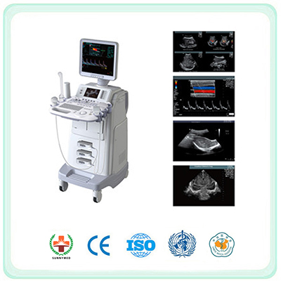 SV480 Color Doppler Ultrasound diagnosis system